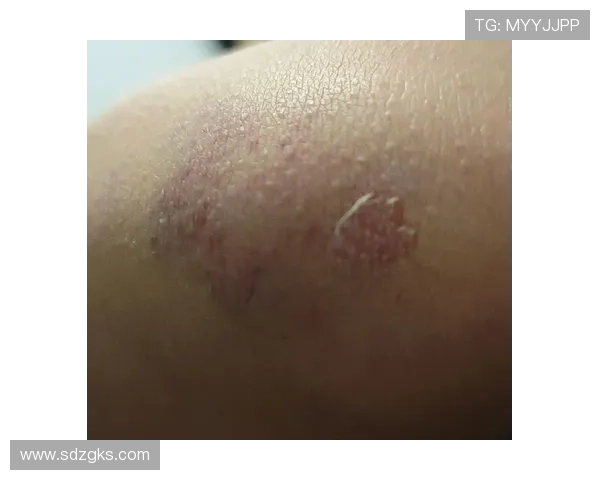 造点建功后晒伤口照引发关注 造点建功后晒伤口照引发关注